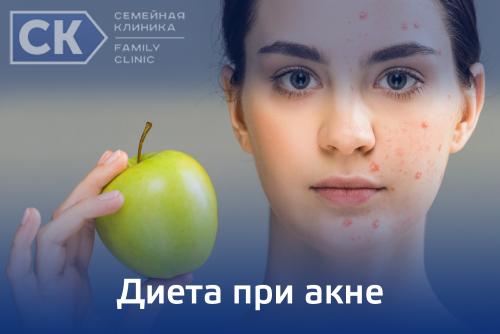 Какие продукты полезны при акне. Список продуктов при акне: что можно есть, а что нет 05 Какие продукты полезны при акне. Список продуктов при акне: что можно есть, а что нет 05
